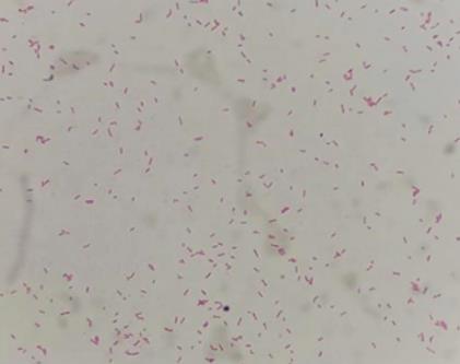 細菌血培養陽性、陰性結果報告解讀