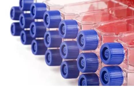 細(xì)胞對(duì)數(shù)增長(zhǎng)期影響因素有哪些