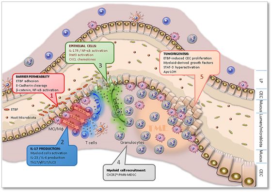 腸道細菌大腸桿菌與脆弱類桿菌聯(lián)合，或能導致結(jié)直腸癌癥發(fā)生