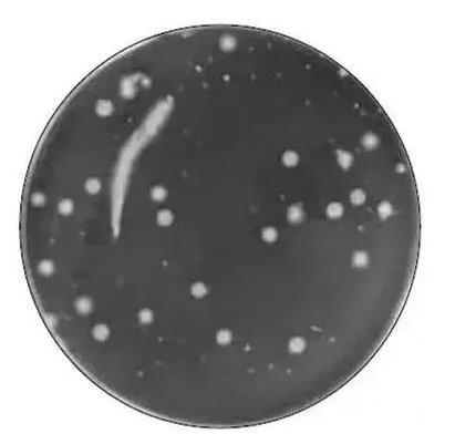 ?菌落計數儀的計數和培養步驟、稀釋標準及注意事項