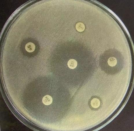 抗生素的作用機制及藥敏試驗方法