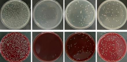 胞內(nèi)菌分類|sRNA對(duì)胞內(nèi)菌生長(zhǎng)的調(diào)控作用（一）