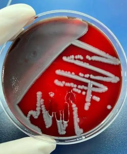 腸炎沙門菌親本株和毒力島基因缺失株的生長(zhǎng)曲線繪制