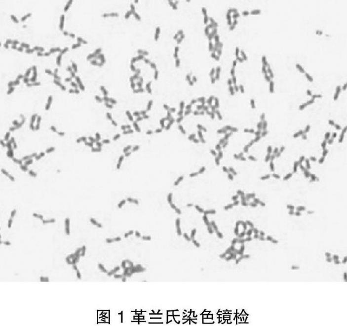豬鏈球菌對34種常用藥物的敏感性檢測【藥敏實驗】