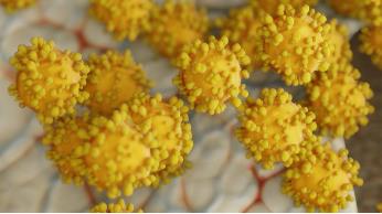 反芻動物瘤胃菌群組成和數量、影響因素及與代謝性疾病關系