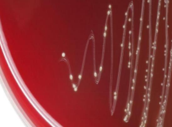 乙型溶血性鏈球菌來源、分類及檢測與診斷【百科知識】