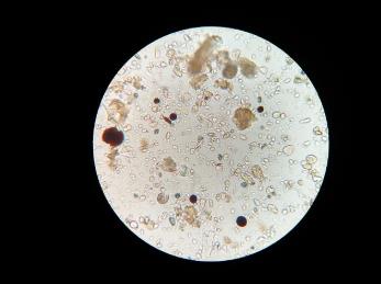 快速藥敏檢測技術方法、原理、臨床轉化需求（一）