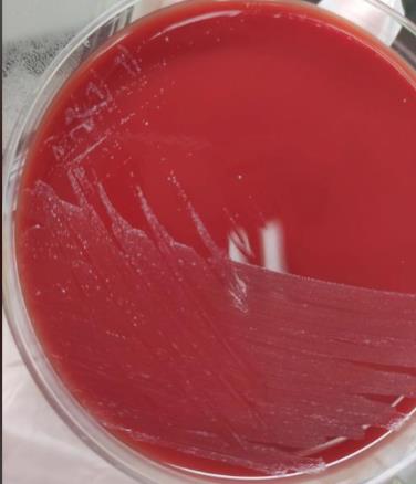 不同保存條件、培養基對淋病奈瑟菌存活率的影響——摘要、材料與方法