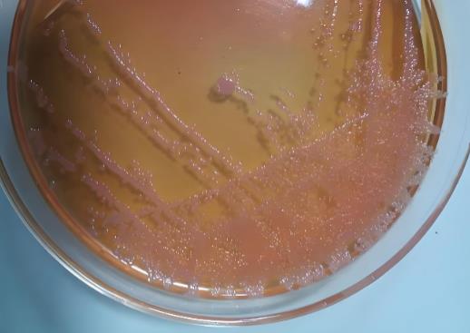 高通量藥敏檢測指導兒童急性白血病個體化治療的初步探索——結果